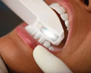 3d scanner dental
