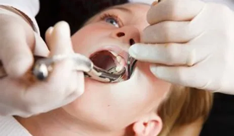 extraction implants gum surgery