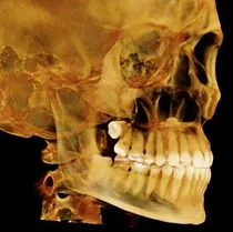3D X-ray dental