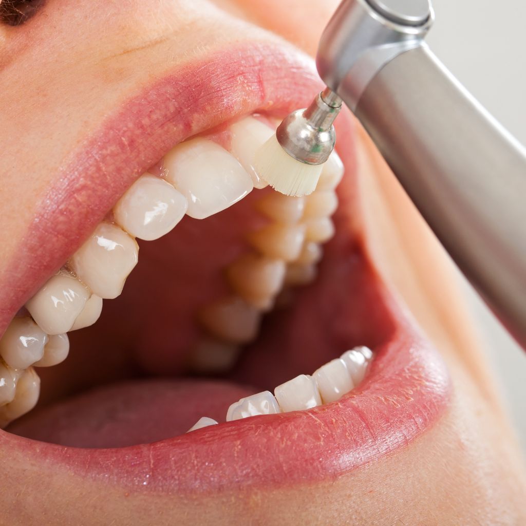 dental polish