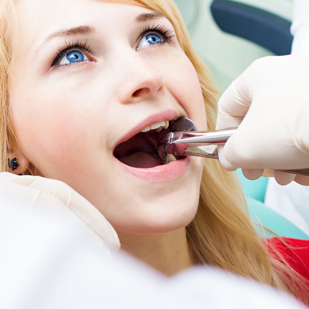 tooth extraction image