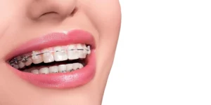 Orthodontist Midtown Image