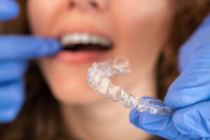 doctor showing invisalign