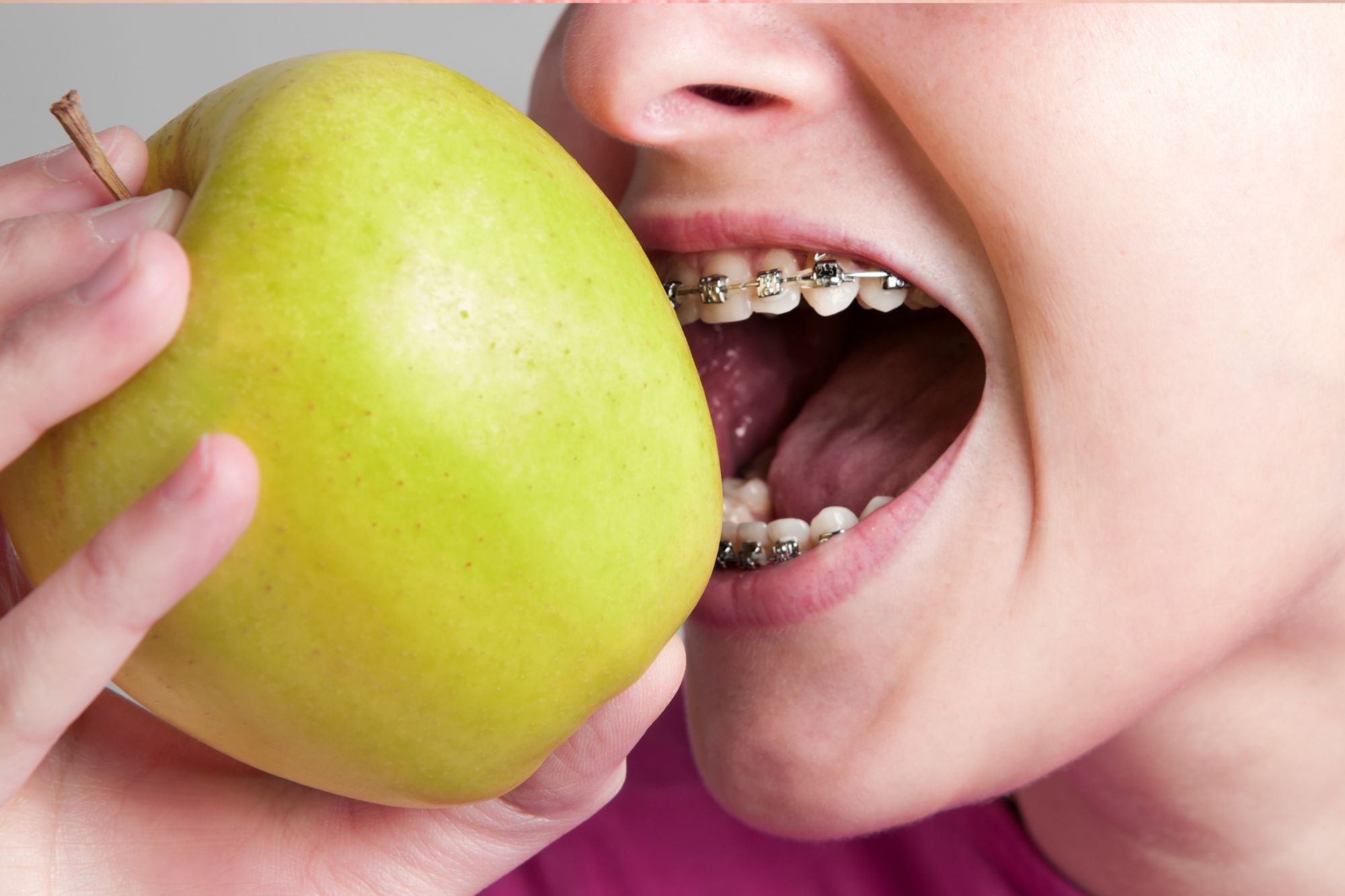 eating with braces