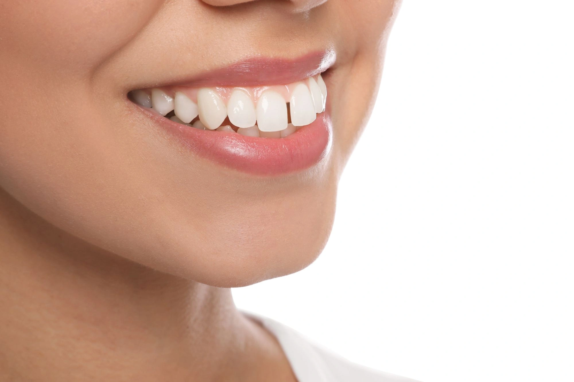 upper teeth significantly Img