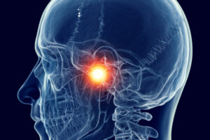 jaw pain