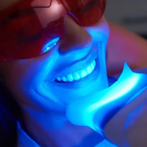 Teeth Whitening Image