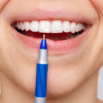 Cropped shot of a young woman pointing to white spot on the tooth enamel with a pen. Oral hygiene, dental health care. Dentistry, demineralization of teeth, enamel hypoplasia, pathology, fluorosis