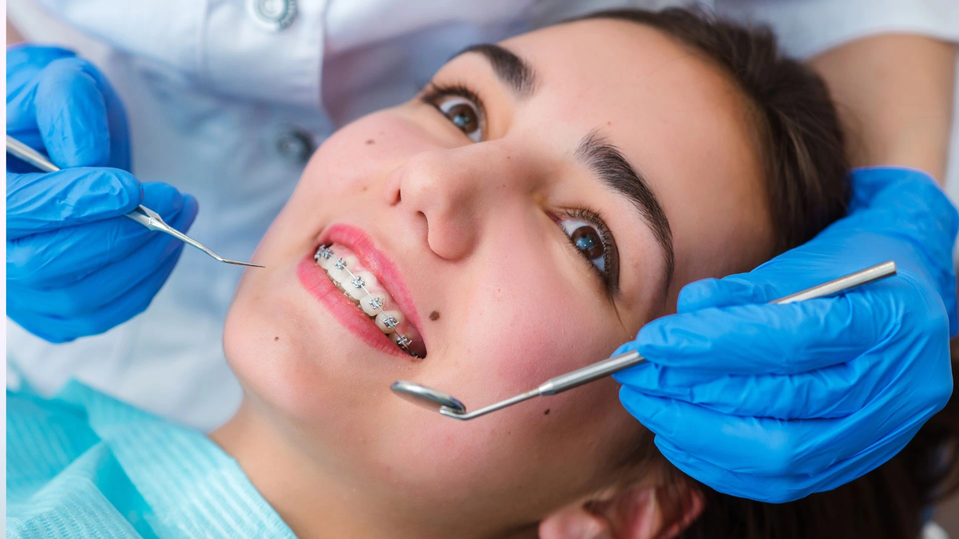 Affordable Braces Image