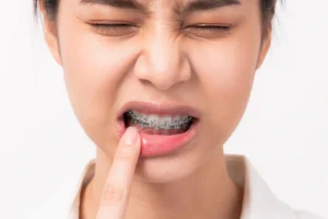 Braces Painful Image