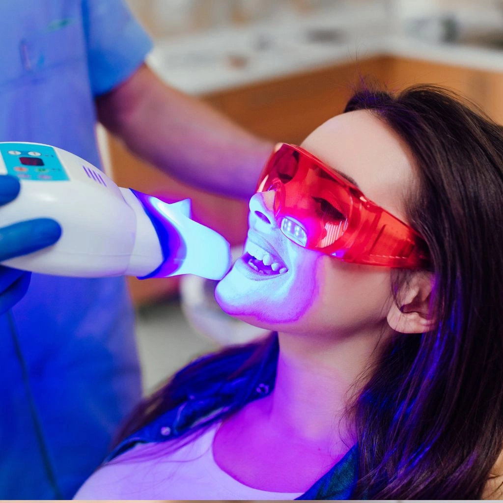 Dental Fillings Img