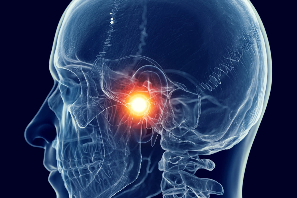 Jaw Pain Image