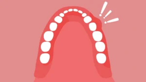 Oral Cancer, Flat Color Illustration Image