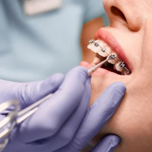 Orthodontics Img