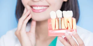 Prosthodontics Image