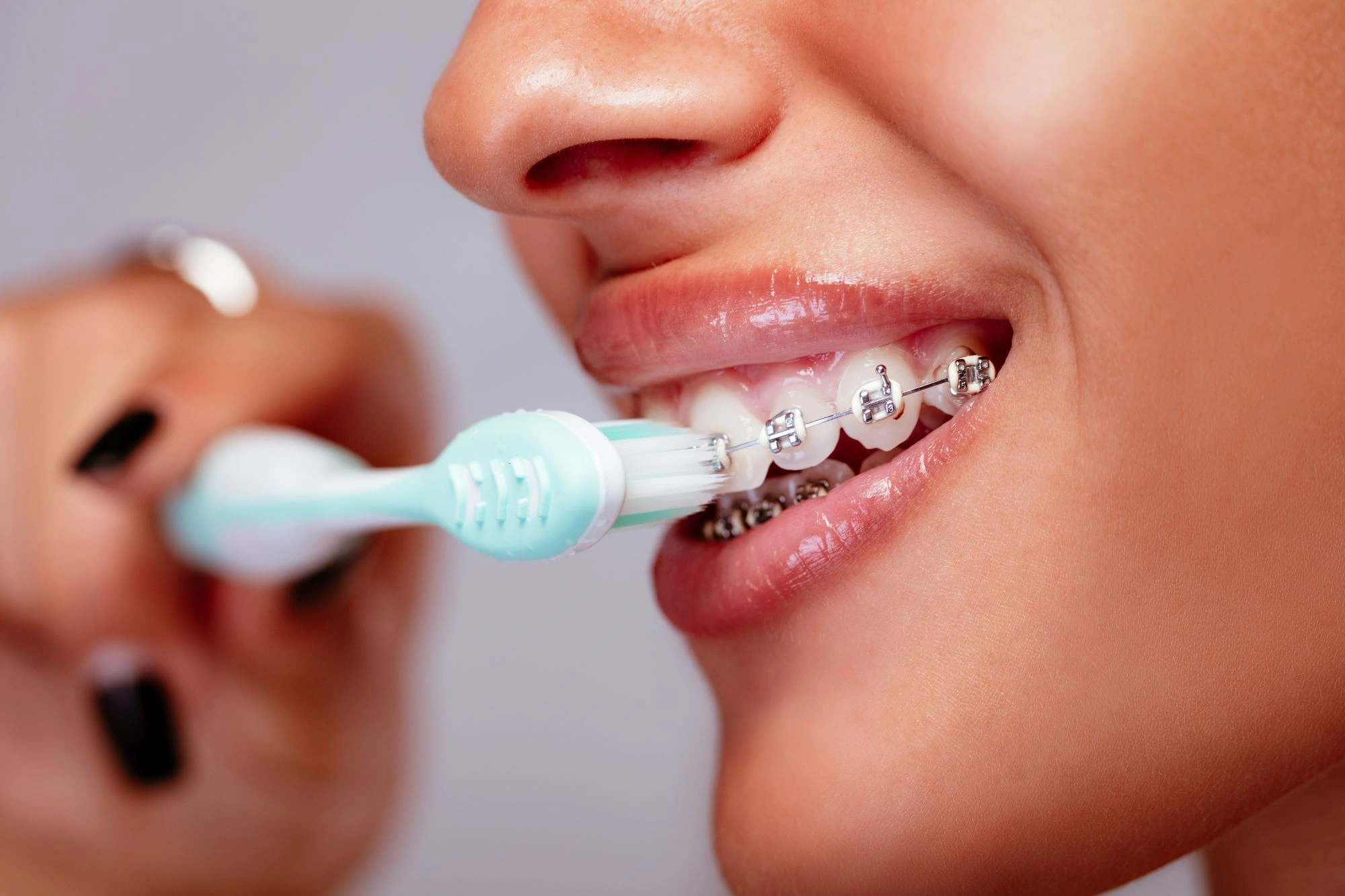 Washing Tooth With Braces Image