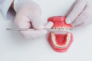 Orthodontist Teeth Is Arranged Image